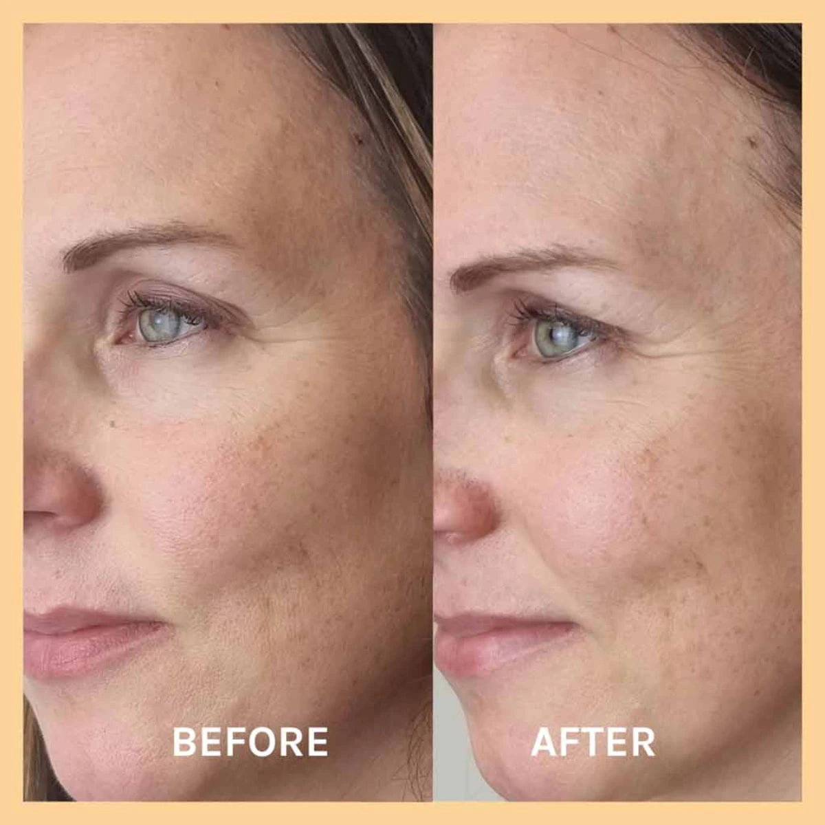 EVOLVE Miracle Vitamin C Mask 60 ml kirkastaa ihoa