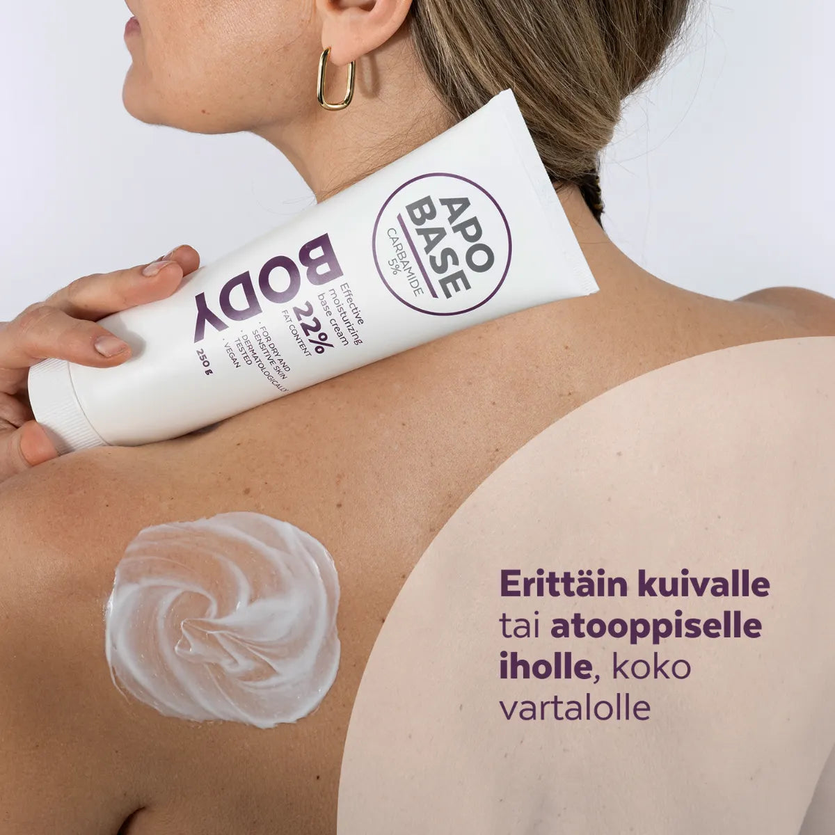 APOBASE Carbamide 5% perusvoide sopii atooppiselle tai erittäin kuivalle iholle