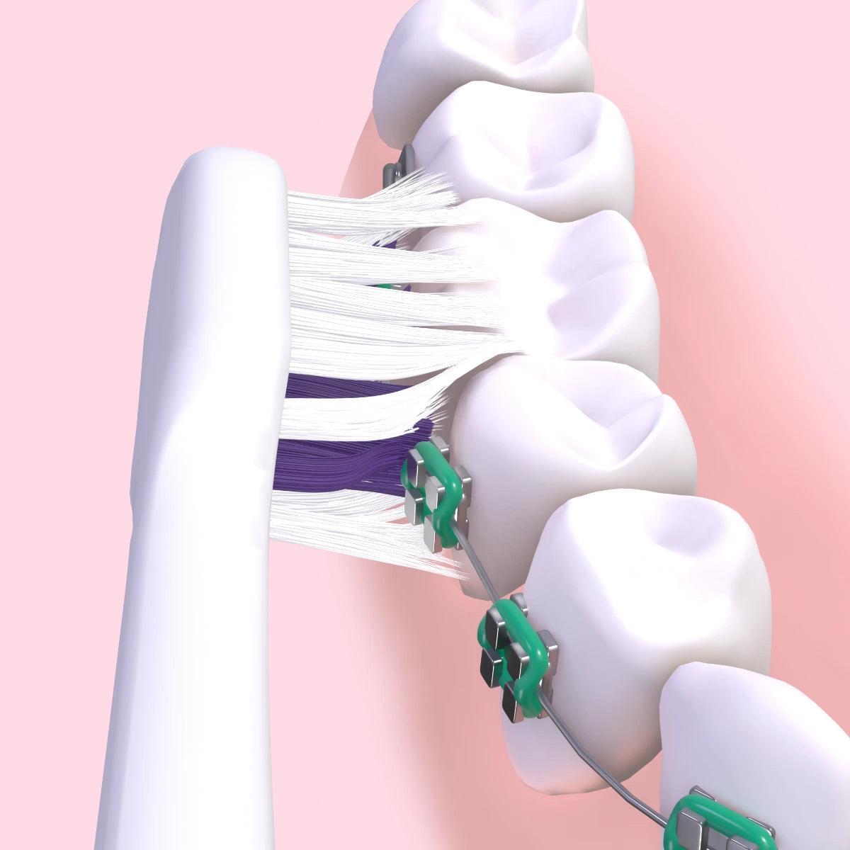 GUM Sonic Ortho paristohammasharja puhdistaa oikomiskojeiden ympäriltä