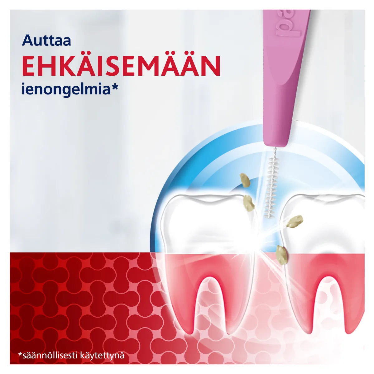 PARODONTAX Interdental Brush 0,4 mm hammasväliharja 6 kpl auttaa ehkäisemään ienongelmia