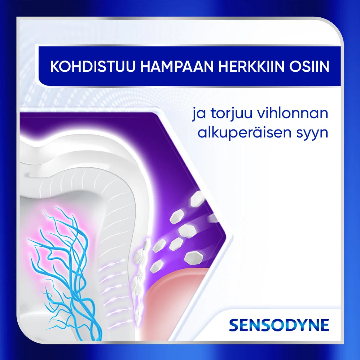 Sensodyne Clinical Repair Active White hammastahna vaikutus kohdistuu hampaan herkkiin osiin torjuen vihlonnan syyn
