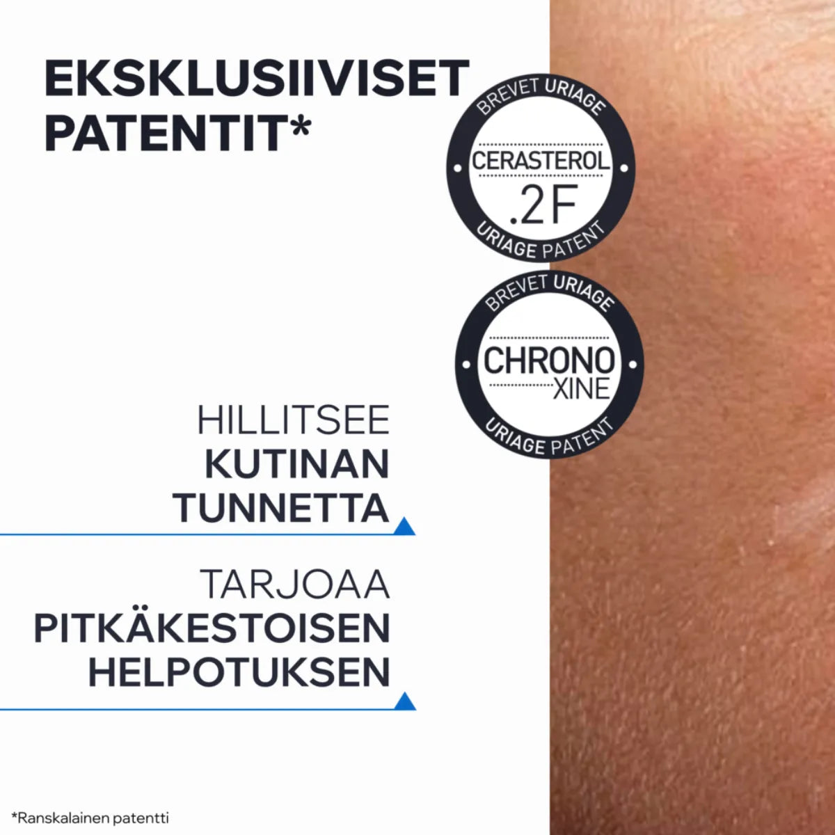 Uriage Xemose C8+ patentti hillitsee kutinaa