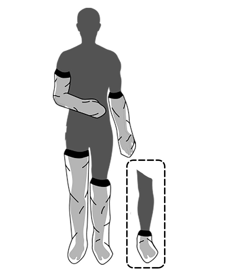 KIPSINSUOJA LIMBO 1/1-PIT REITEEN M100 1 KPL